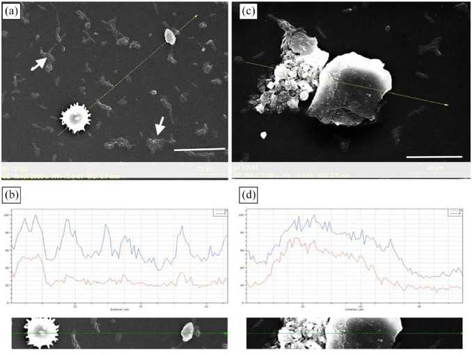 A unique late-onset intraocular lens opacification 23 years after implantation: a clinical and laboratory case report.