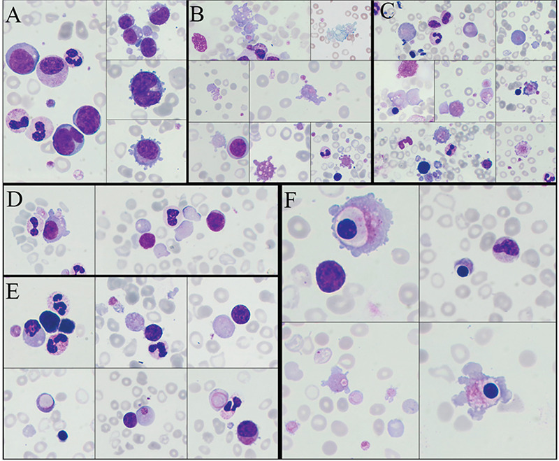 Unusual Clasmatosis Morphology