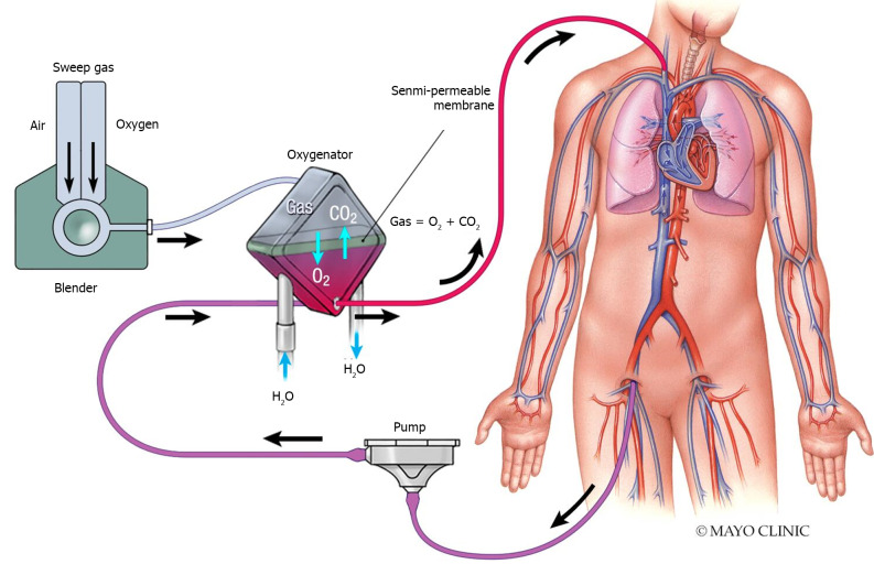 Inhaled volatile anesthetics in the intensive care unit.