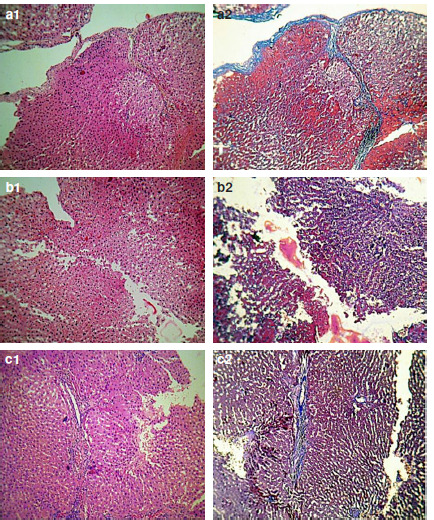 Safety and hemostatic effect of <i>Achillea millefolium</i> L. in localized bleeding.