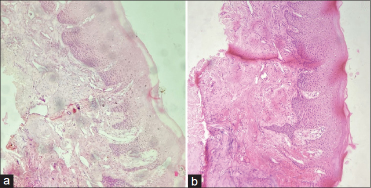 Standardization of honey as a tissue fixative for histopathology: A morphometric study.