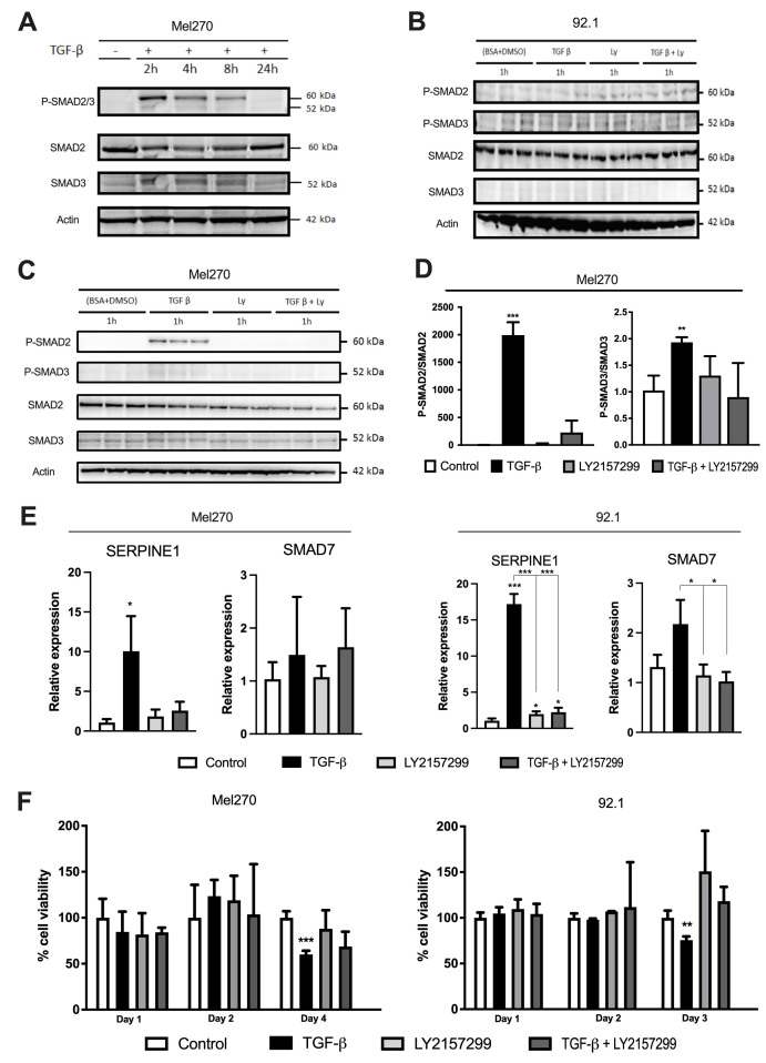 Uveal melanoma cell lines Mel270 and 92.1 exhibit a mesenchymal phenotype and sensitivity to the cytostatic effects of transforming growth factor beta in vitro.
