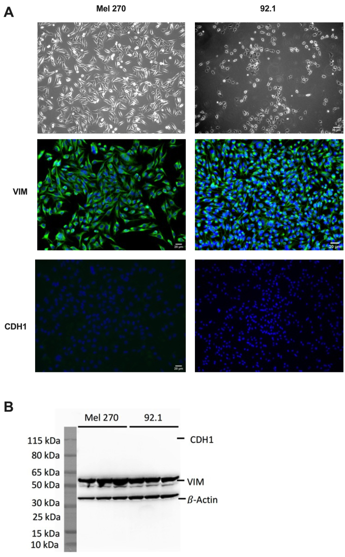 Uveal melanoma cell lines Mel270 and 92.1 exhibit a mesenchymal phenotype and sensitivity to the cytostatic effects of transforming growth factor beta in vitro.