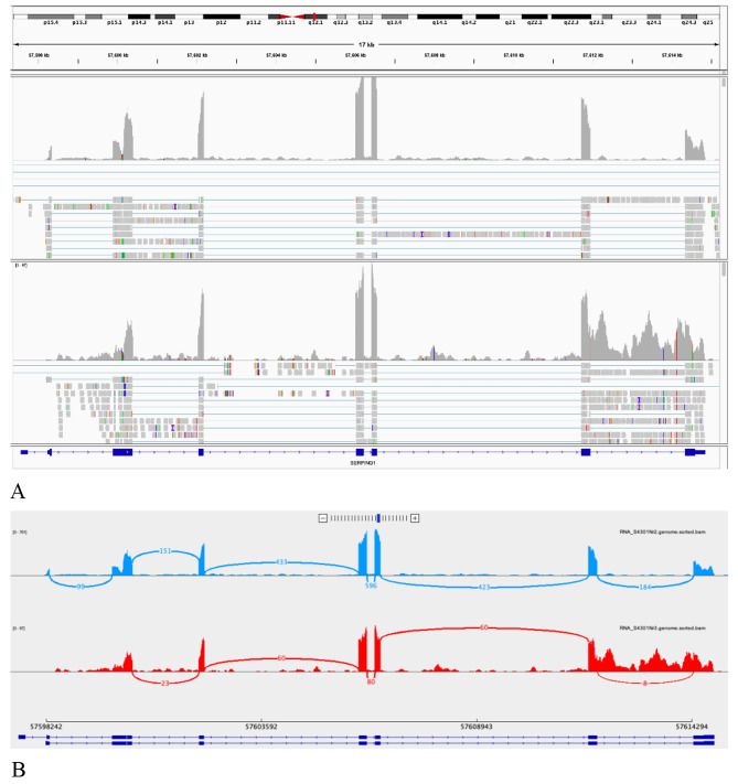 Hereditary or acquired? Comprehensive genetic testing assists in stratifying angioedema patients.