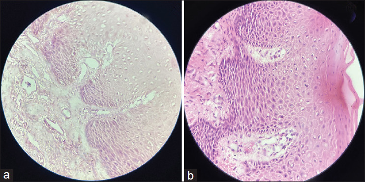 Standardization of honey as a tissue fixative for histopathology: A morphometric study.