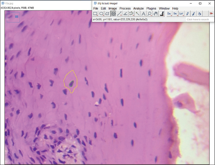 Standardization of honey as a tissue fixative for histopathology: A morphometric study.