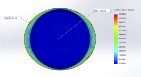[Compressive stress in three types of finishing lines with lithium disilicate crowns in permanent teeth: finite element analysis].