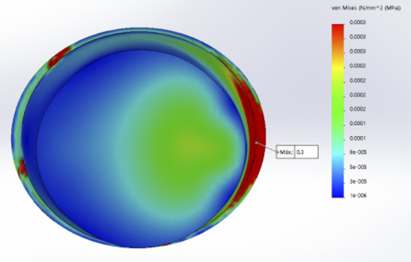 [Compressive stress in three types of finishing lines with lithium disilicate crowns in permanent teeth: finite element analysis].