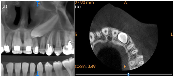 摘要图片