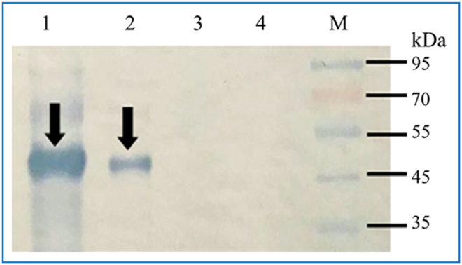 A dot-blot ELISA preliminary evaluation using PvMSP1-42 recombinant protein as antigen for serological diagnosis of Plasmodium vivax infection in Thailand.