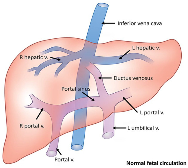 Absence of Ductus Venosus: A Comparison of 2 Distinctive Fetal Autopsy Cases and Embryologic Perspectives.