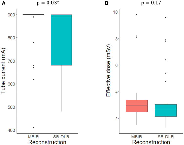 Super-resolution deep learning reconstruction to improve image quality of coronary CT angiography.