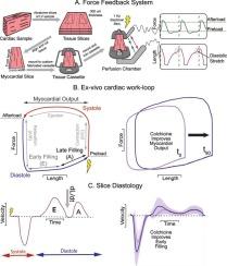 Microtubule destabilization with colchicine increases the work output of myocardial slices