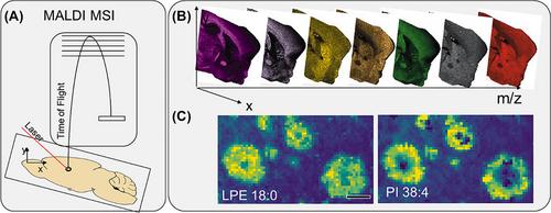 Spatial neurolipidomics—MALDI mass spectrometry imaging of lipids in brain pathologies