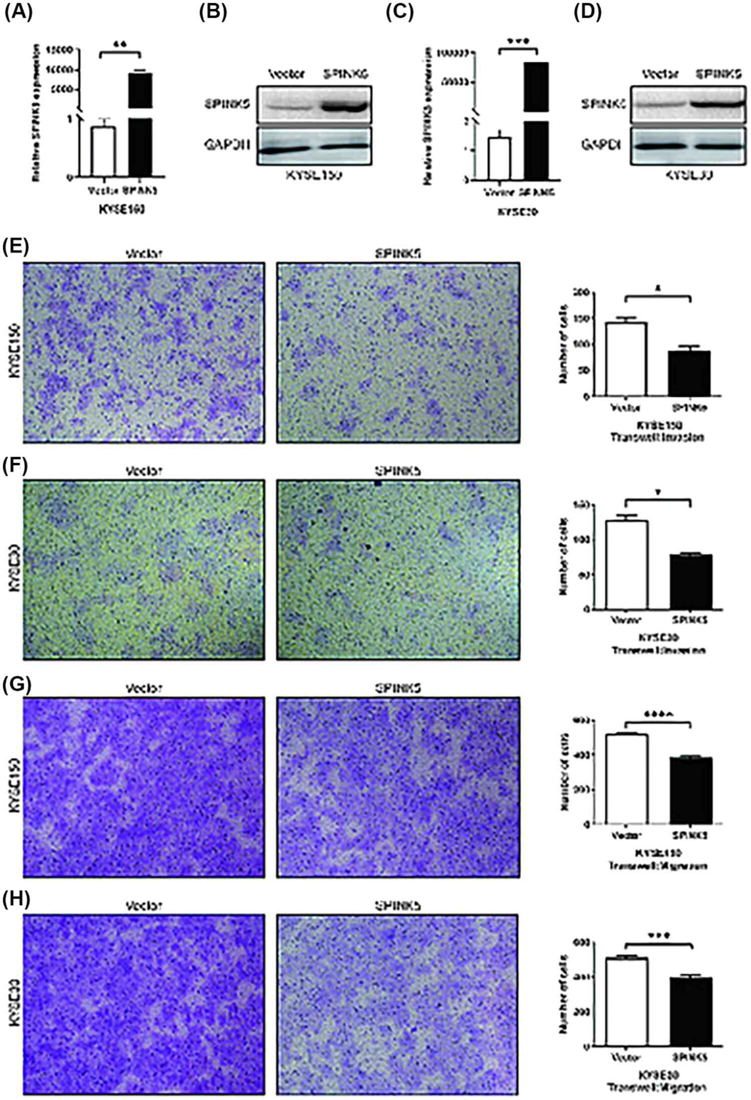 SPINK5 inhibits esophageal squamous cell carcinoma metastasis via immune activity