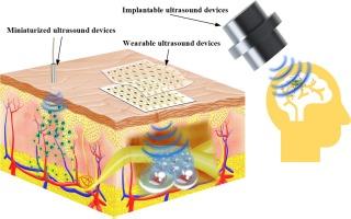 Miniaturized therapeutic systems for ultrasound-modulated drug delivery to the central and peripheral nervous system