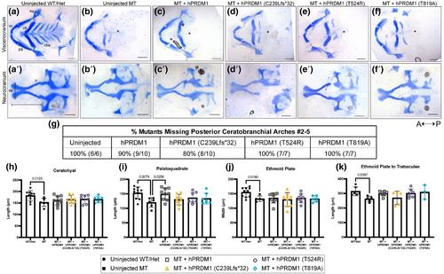 Human split hand/foot variants are not as functional as wildtype human PRDM1 in the rescue of craniofacial defects