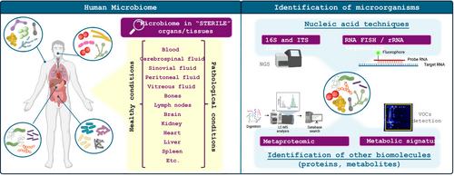 Are there any completely sterile organs or tissues in the human body? Is there any sacred place?