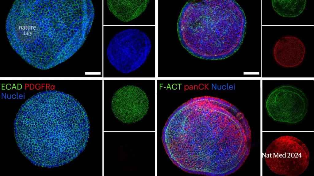 Growing organoids from amniotic fluid may help prenatal diagnosis