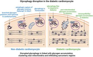 Myocardial glycophagy flux dysregulation and glycogen accumulation characterize diabetic cardiomyopathy