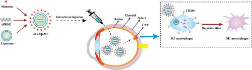 M2-type macrophage-targeted delivery of IKKβ siRNA induces M2-to-M1 repolarization for CNV gene therapy