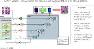 CellViT: Vision Transformers for precise cell segmentation and classification