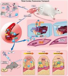 Tibial cortex transverse transport regulates Orai1/STIM1-mediated NO release and improve the migration and proliferation of vessels via increasing osteopontin expression