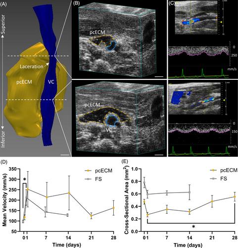 Photocurable extracellular matrix sealant for cessation of venous hemorrhage