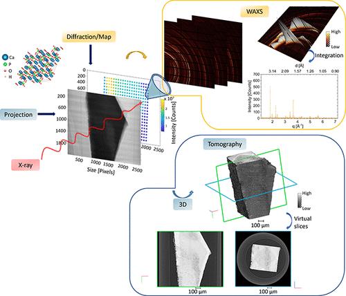 The DIAD Approach to Correlative Synchrotron X-ray Imaging and Diffraction Analysis of Human Enamel