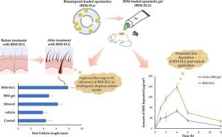 Spanlastic-laden nanogel as a plausible platform for dermal delivery of bimatoprost with superior cutaneous deposition and hair regrowth efficiency in androgenic alopecia