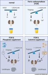 Intravenous iron-induced hypophosphatemia and kidney stone disease