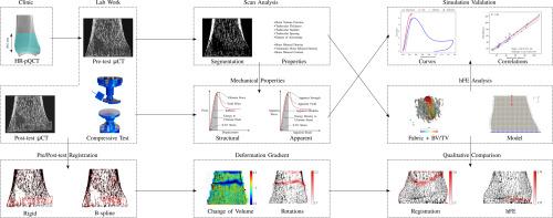 Homogenized finite element analysis of distal tibia sections: Achievements and limitations