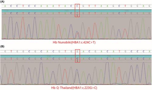 Molecular Characterization of α- and β-Thalassemia Among Children Less Than 18 Years Old in Guizhou, China