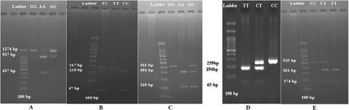 Association of the ESR1 (rs9340799), OLR1 (rs3736234), LIPC (rs2070895), VDR (rs2228570), and CETP (rs708272) Polymorphisms With Risk of Coronary Artery Disease in Iranian Patients