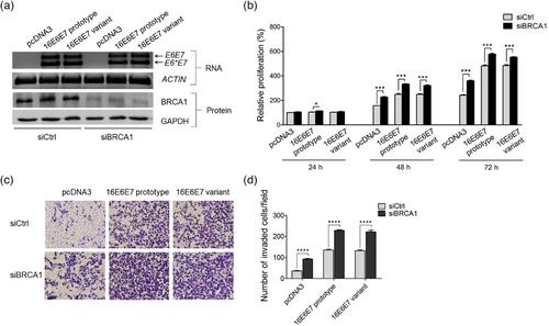 BRCA1 deficiency enhances the aggressiveness of breast cancer cells expressing HPV16 oncoproteins