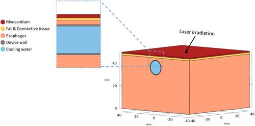 Proactive esophageal cooling during laser cardiac ablation: A computer modeling study