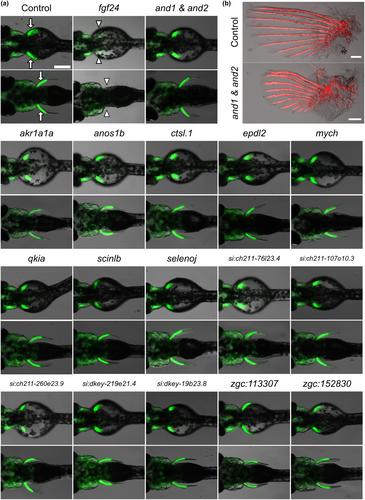 Genomic screening of fish-specific genes in gnathostomes and their functions in fin development