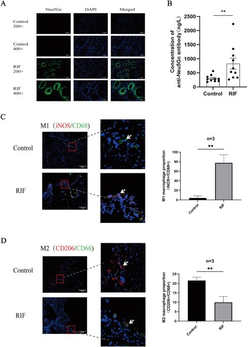 Neu5Gc regulates decidual macrophages leading to abnormal embryo implantation