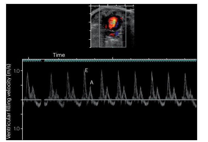 Modelling pre-eclampsia and its cardiovascular effects