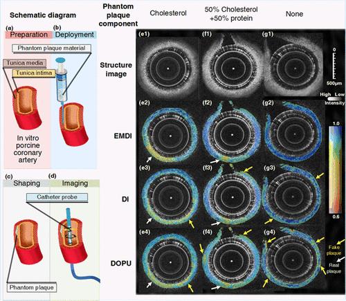 Estimation of Medium Depolarization Index with Noise Immunity in Catheter-Based PS-OCT toward Vascular Plaques Detection