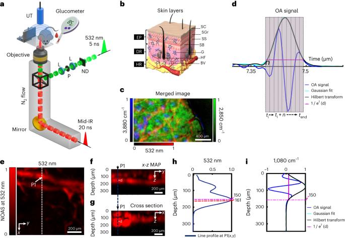 Non-invasive measurements of blood glucose levels by time-gating mid-infrared optoacoustic signals