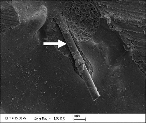 Effects of different surface treatments on surface topography and bond strength in the repair of fiber-reinforced dentin composite