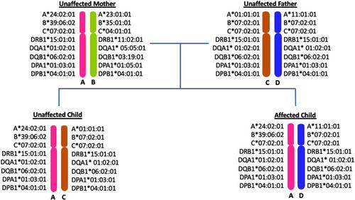 Homozygous HLA-DQB1*06:02 combined with T-cell receptor alpha polymorphism results in narcolepsy onset – A familial case report