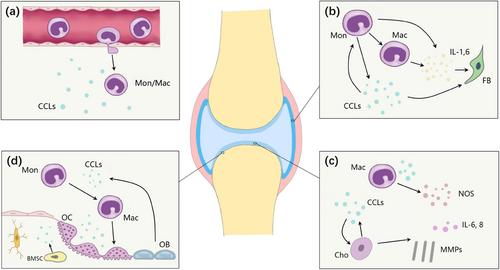 The role of monocyte/macrophage chemokines in pathogenesis of osteoarthritis: A review