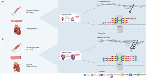 Oral ribose supplementation in dystroglycanopathy: A single case study