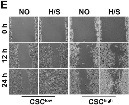 Correction to ‘Autophagy mediates survival of pancreatic tumour-initiating cells in a hypoxic microenvironment’