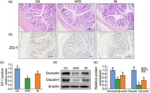 Isoleucine-restricted diets improve high-fat diet-induced nonalcoholic fatty liver disease via regulating insulin resistance and gut microbiota