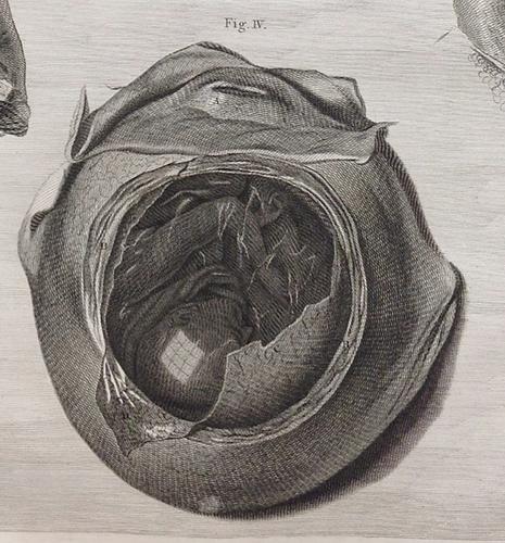 Windows on the Womb and Guiding Trains of Light: Figuring the Real in Plate XXVI of William Hunter's Anatomy of the Human Gravid Uterus