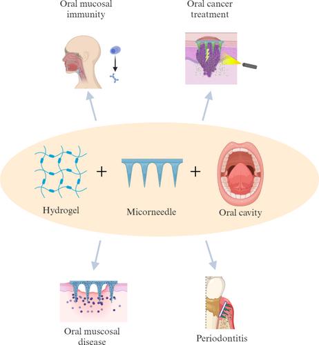 Application of hydrogel microneedles in the oral cavity