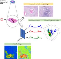 Suitability of Fourier transform infrared microscopy for the diagnosis of cystic echinococcosis in human tissue sections